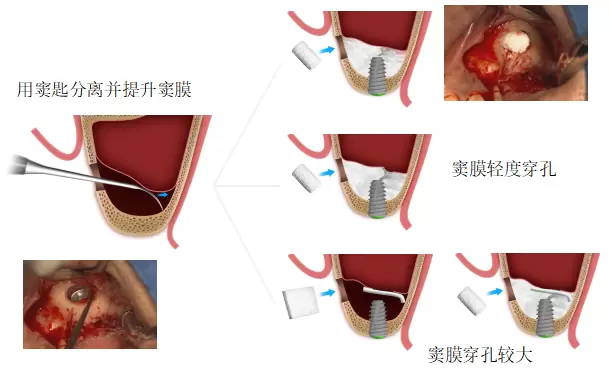 【韩国登腾展商推荐】DenTech China 2024上海口腔展 | 探索前沿齿科科技